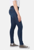 Midge Zip Skinny Jeans