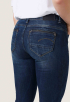 Midge Zip Skinny Jeans